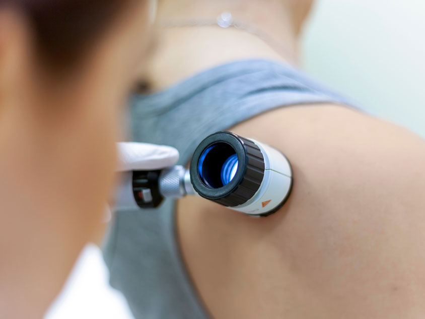 A health professional performing a skin check